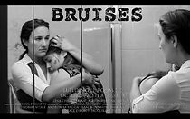 Watch Bruises (Short 2018)
