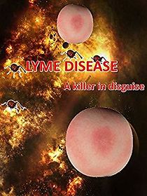 Watch LYME Disease: The Killer in Disguise