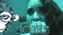 Watch Scars